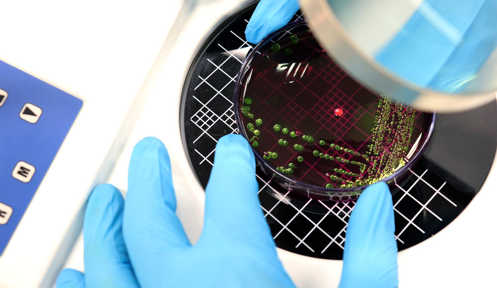 Bacterial count in next-generation probiotics: AFU technology