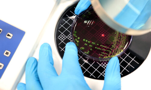 Bacterial count in next-generation probiotics: AFU technology